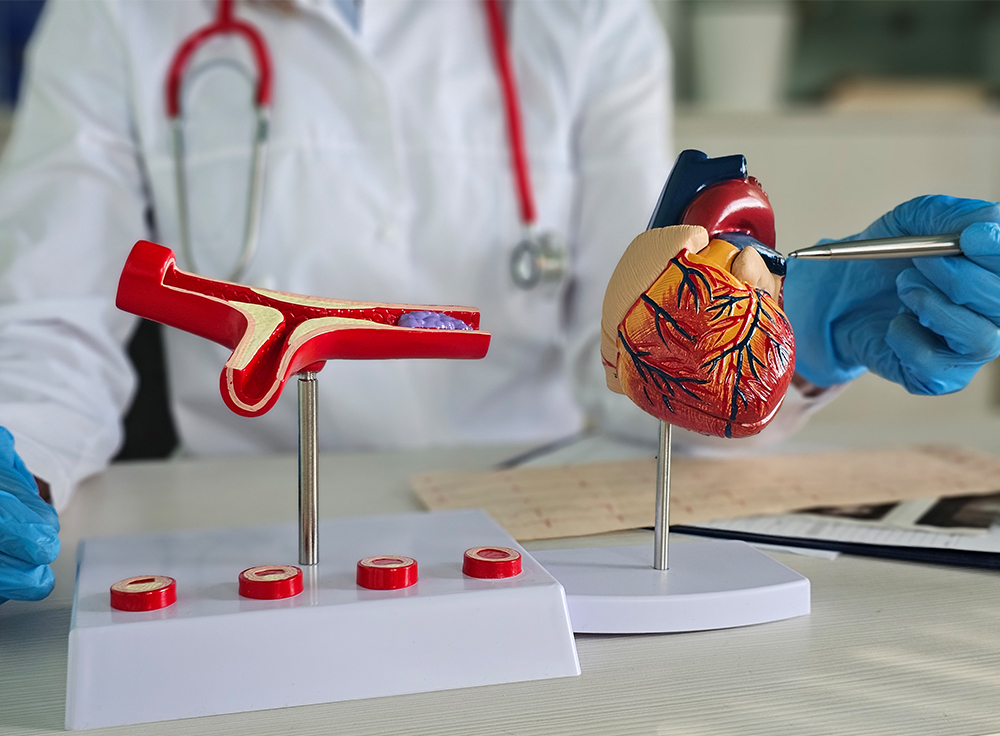 Coronary artery disease treatment in Brooklyn NY